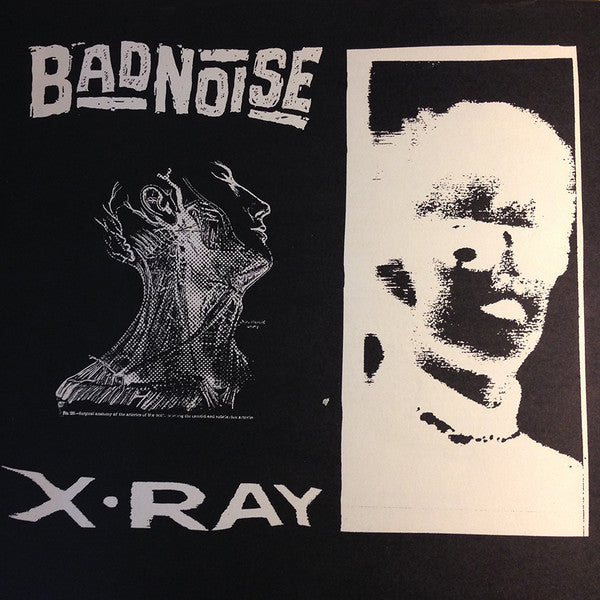 Bad Noise  X-Ray - Vinilo Simple - Usado